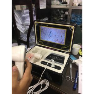 Máy Soi Da Có Màn Hình 7 inch dùng trong spa, thẩm mỹ viện