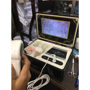 Máy Soi Da Có Màn Hình 7 inch dùng trong spa, thẩm mỹ viện