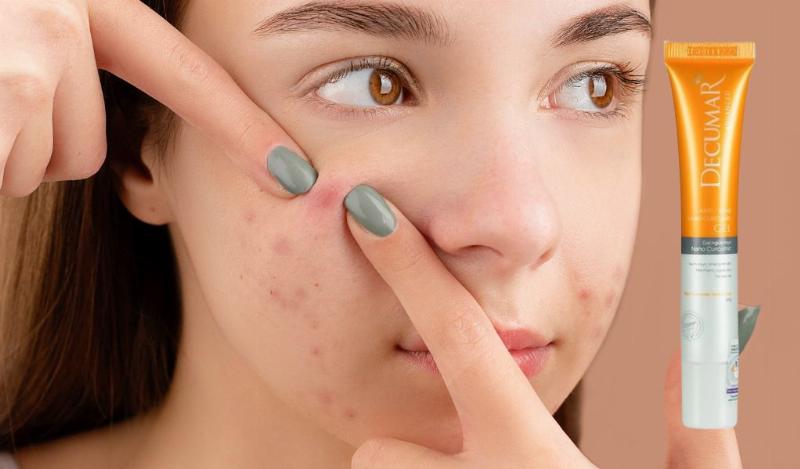 Ai Nên Sử Dụng Decumar