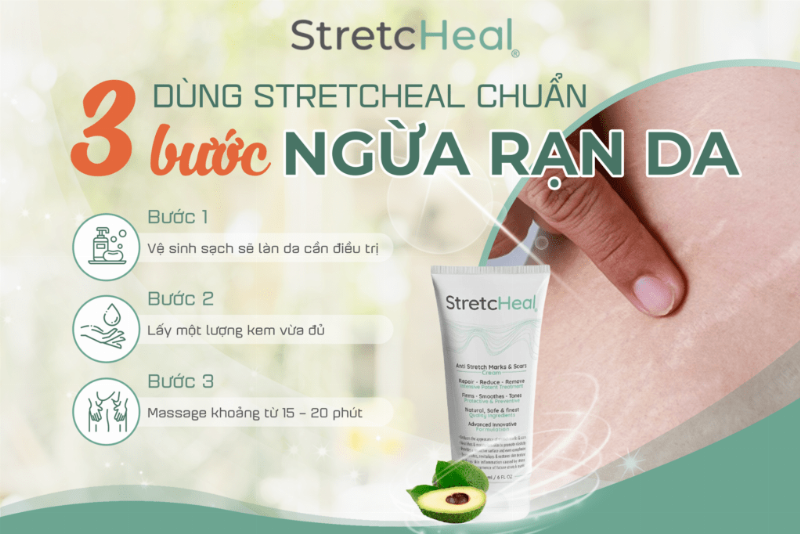 huong-dan-su-dung-kem-tri-ran-stretcheal-hieu-qua
