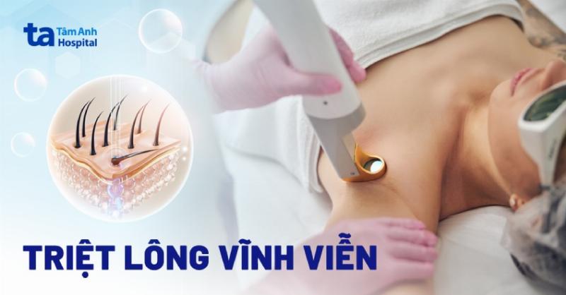 Cảm giác triệt lông nam: Có đau không?