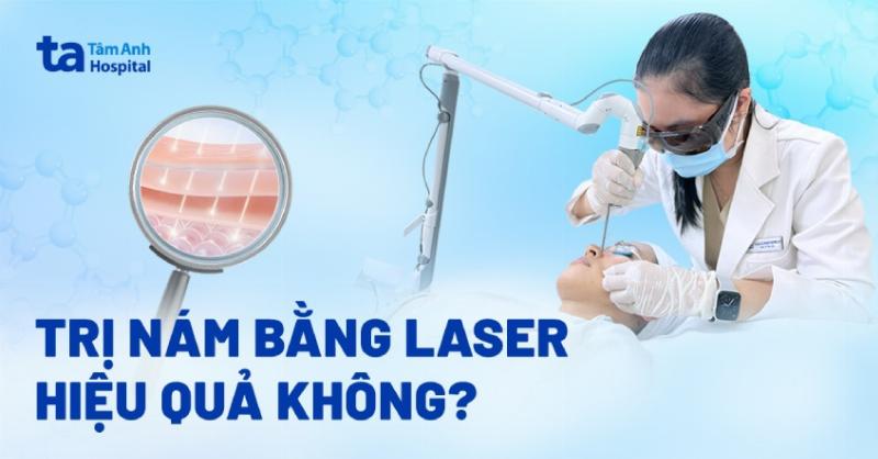 Điều trị nám bằng laser