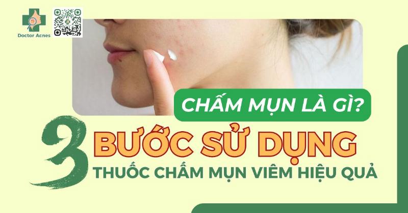 Hướng dẫn sử dụng kem chấm mụn hiệu quả
