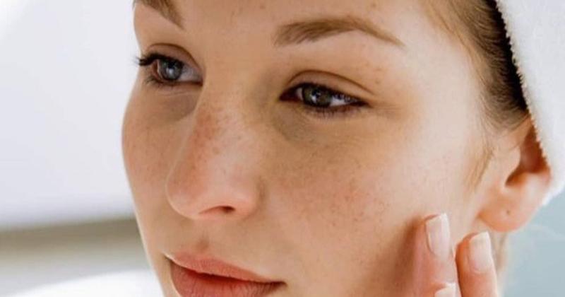 Kem trị nám hiệu quả