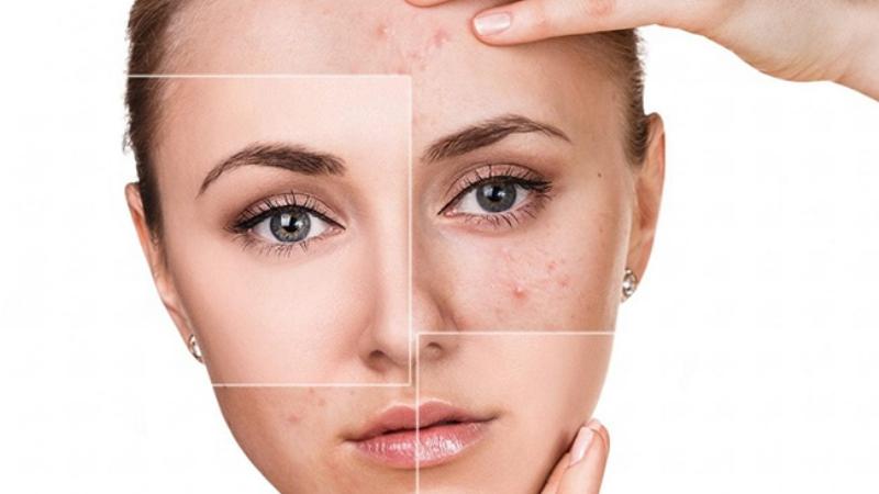 Kem Trị Sẹo Thâm Chứa Vitamin C