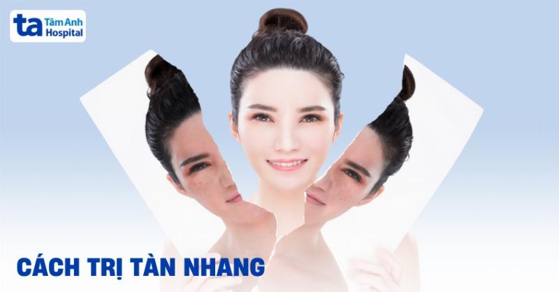 anh-kem-tri-tan-nhang-gia-re-hieu-qua