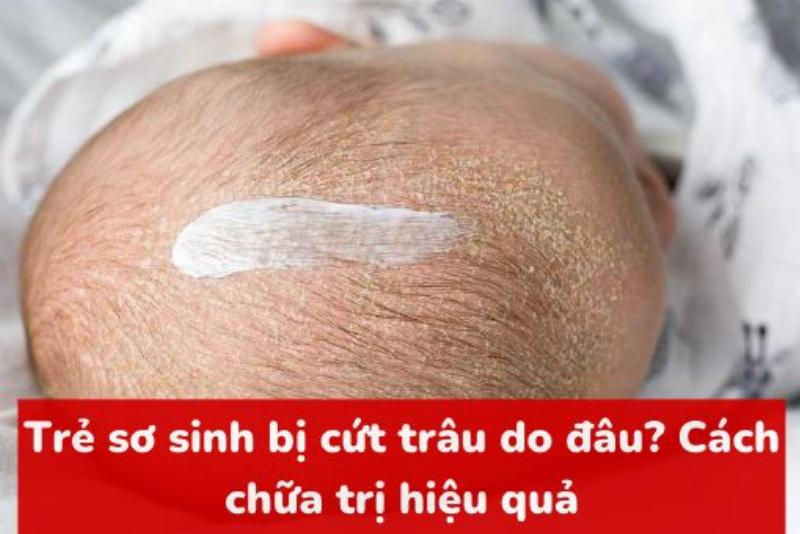 Mẹo nhỏ giúp tăng hiệu quả khi sử dụng gội đầu khô