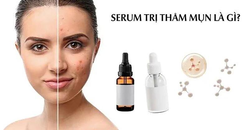 cac-loai-serum-tri-tham-mun-tot-nhat
