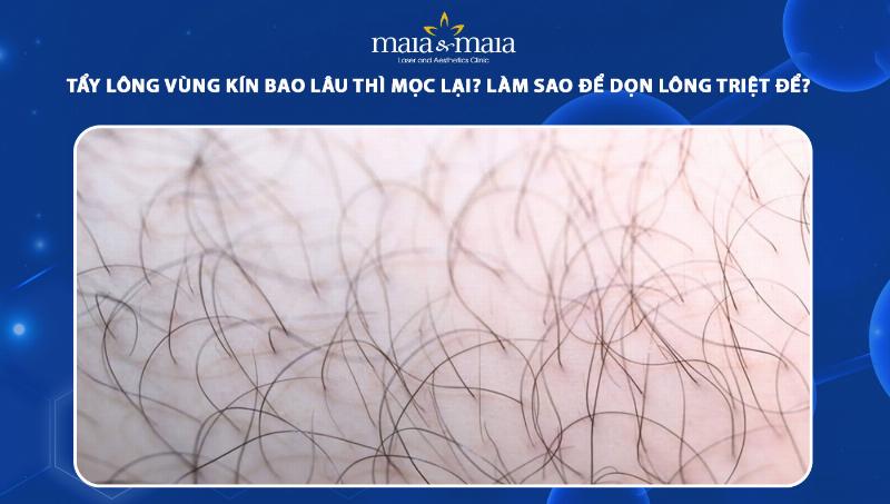 Bảng so sánh các yếu tố chính giữa triệt lông tại nhà bằng máy và triệt lông tại spa, giúp người đọc đưa ra quyết định phù hợp với nhu cầu và ngân sách của bản thân