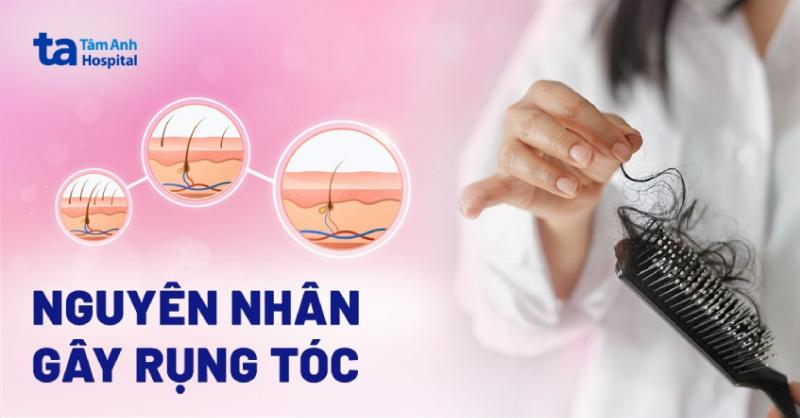 nhung-tha-mac-thuong-gap-ve-thuoc-xit-moc-toc