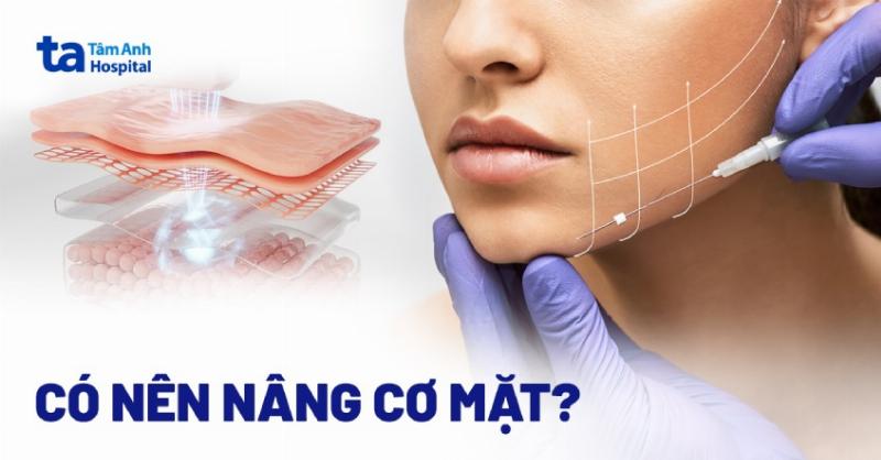 So sanh cac cong nghe nang co mat khong phau thuat pho bien hien nay