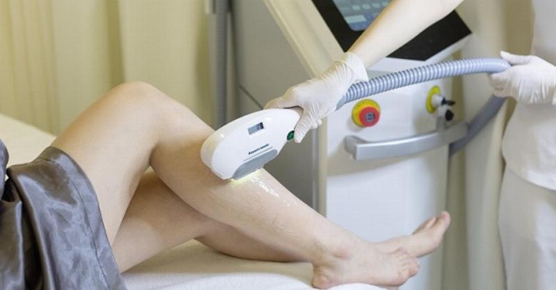 So sánh các phương pháp cách triệt lông tại nhà: ưu nhược điểm