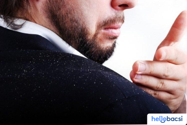 Các bước sử dụng dầu gội trị gàu chuẩn nhất tại nhà