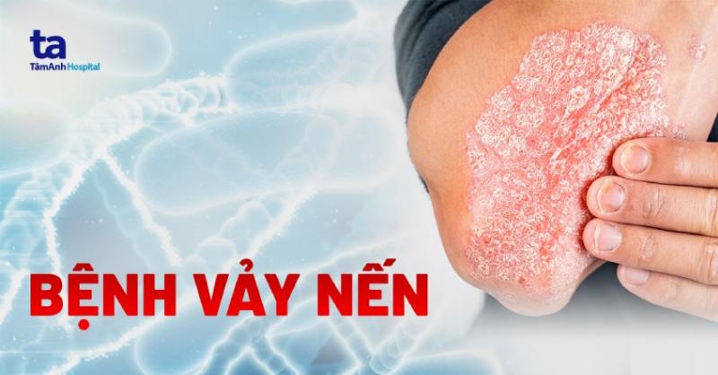 Minh họa cách tẩy da chết cho da toàn thân, tập trung vào các vùng da sần sùi như khuỷu tay, đầu gối.
