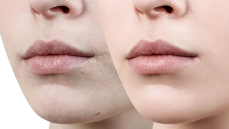 Các nguyên liệu tự nhiên giúp trị thâm viền môi tại nhà hiệu quả và an toàn.