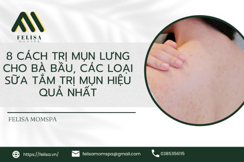 Minh họa các câu hỏi thường gặp về Lifebuoy sữa tắm dưới dạng Q&A