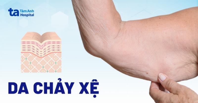 Hinh minh hoa cau truc da va tac dong cua lao hoa gay chay xe, mat san chac