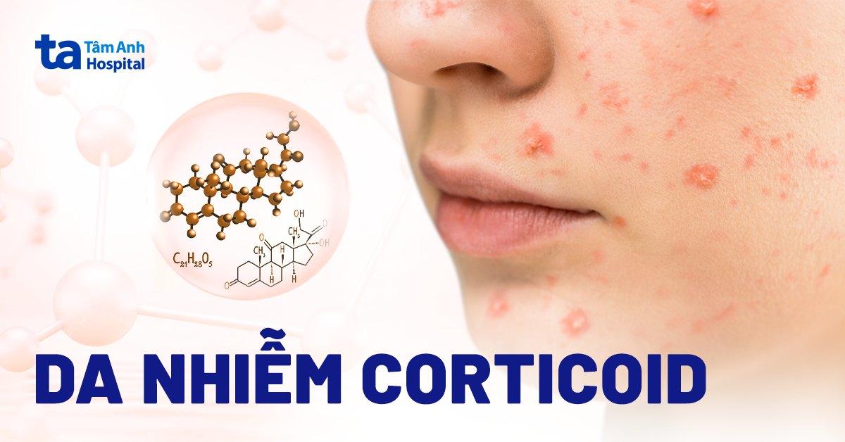 Nhận biết các dấu hiệu của làn da dầu mụn cần chăm sóc