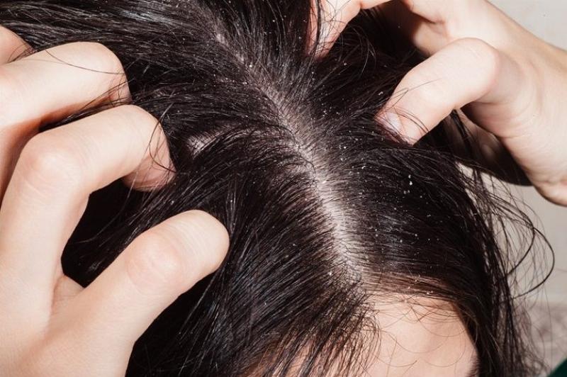 Hình ảnh minh họa các đối tượng nên sử dụng dầu gội nhuộm tóc