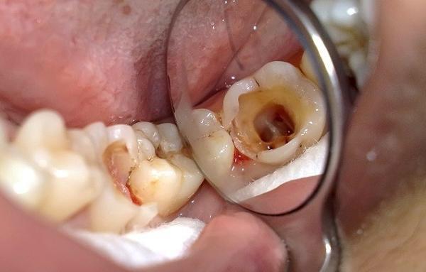 Hình ảnh minh họa các bước đánh răng đúng cách khi sử dụng kem đánh răng Thái Dương, bao gồm lượng kem, kỹ thuật chải và súc miệng
