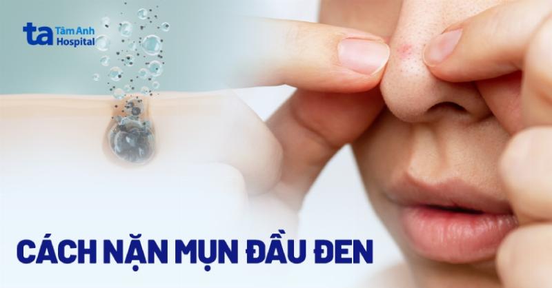 Các bước cơ bản sử dụng serum trị mụn đúng cách tại nhà
