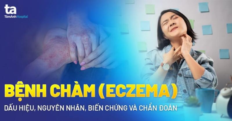 Hình ảnh minh họa hương liệu nhân tạo có thể gây kích ứng da lưng nhạy cảm