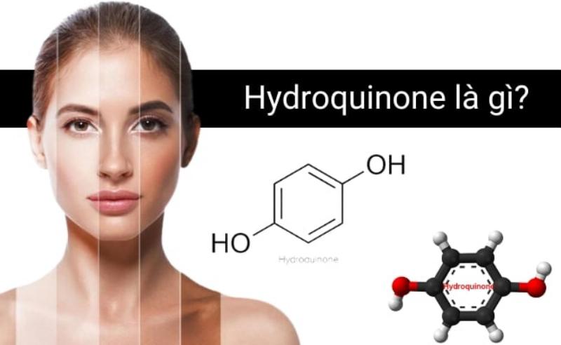 Biểu đồ/đồ họa đơn giản minh họa việc kết hợp kem Olay trị nám với các phương pháp chuyên sâu (laser, peel) để đạt hiệu quả tối ưu