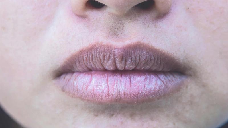 Giải pháp khắc phục tình trạng môi xăm bị xỉn màu sau phun