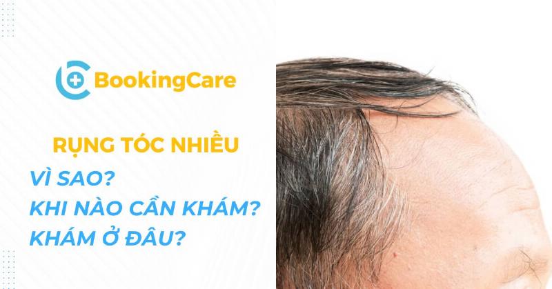 Thời điểm thích hợp để tìm kiếm sự tư vấn từ chuyên gia da liễu khi bị rụng tóc