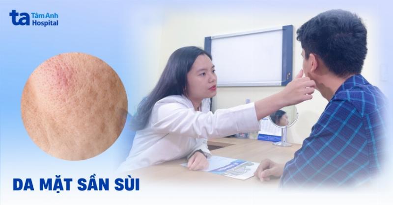 Hình ảnh minh họa các dấu hiệu da cần đổi sữa rửa mặt: da đỏ, khô căng, nổi mụn, hoặc chai sữa rửa mặt cũ sắp hết.