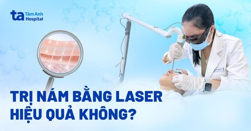 Hinh anh lan da rang ro, tu tin sau khi duoc bac si da lieu da nang chuyen nghiep dieu tri