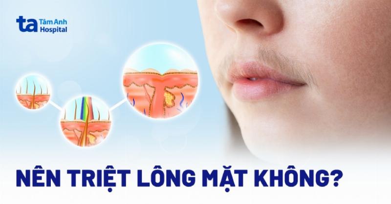 Các lợi ích vượt trội khi sử dụng máy triệt lông diode laser mang lại làn da mịn màng