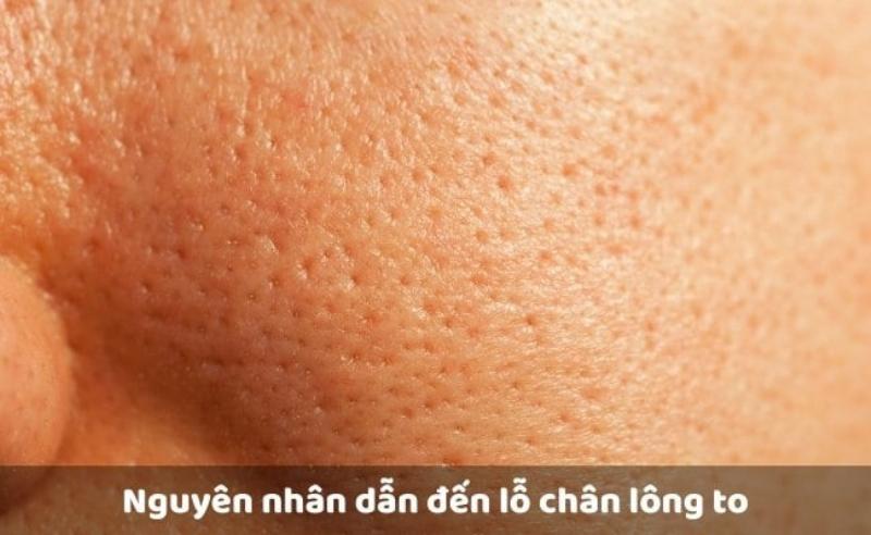 Hỗn hợp nước ép dưa leo và lòng trắng trứng, giúp kiểm soát dầu và se khít lỗ chân lông.