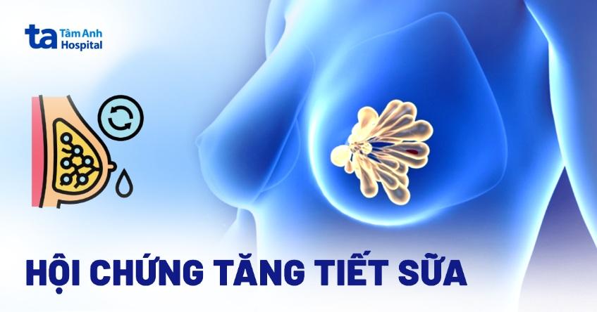 Các nguyên nhân tiềm ẩn gây ra hiện tượng chảy sữa không do mang thai hoặc cho con bú.