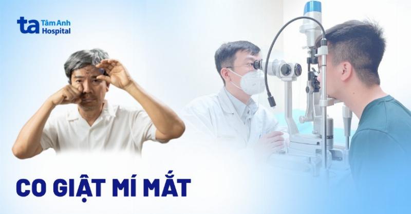 Các nguyên nhân khoa học phổ biến dẫn đến hiện tượng giật mắt trái ở phụ nữ như stress, thiếu ngủ, mỏi mắt.