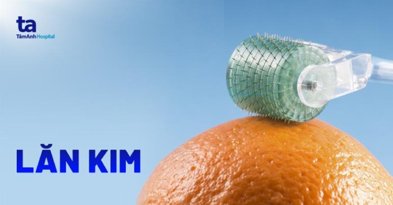 Biểu đồ so sánh những điều nên làm và nên tránh khi chăm sóc da sau lăn kim.