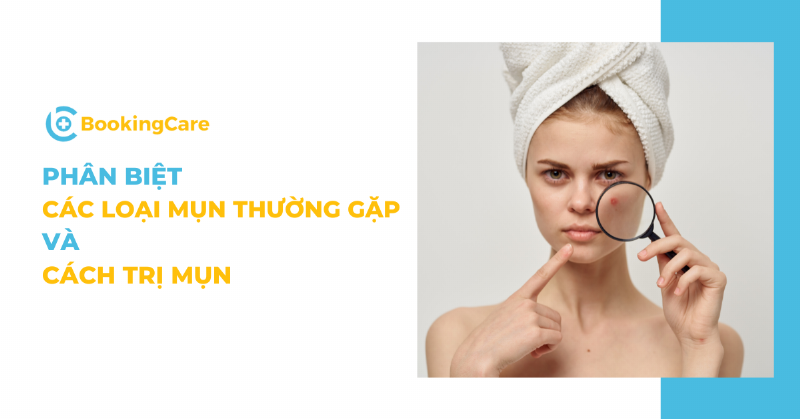 Phân biệt mụn đầu đinh và mụn trứng cá: So sánh các đặc điểm chính để phân biệt mụn đầu đinh với mụn trứng cá thông thường