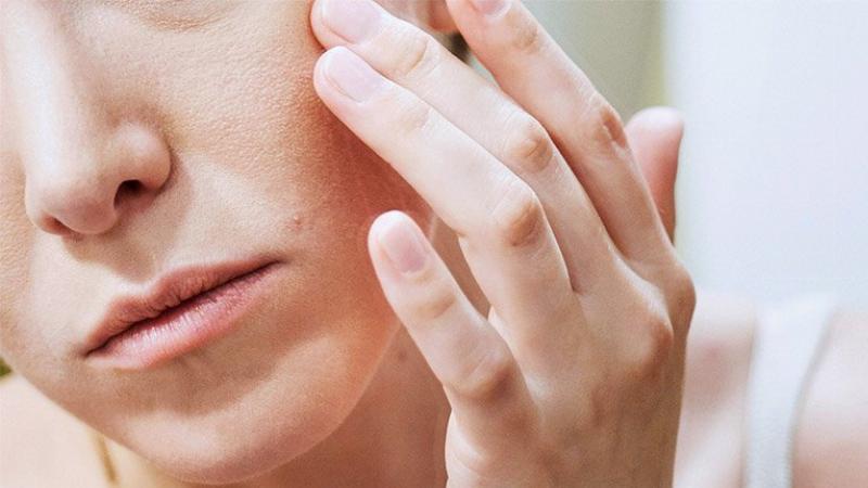 Minh họa da mặt bị đỏ và nổi mẩn nhẹ, dấu hiệu có thể của phản ứng kích ứng hoặc dị ứng với nha đam