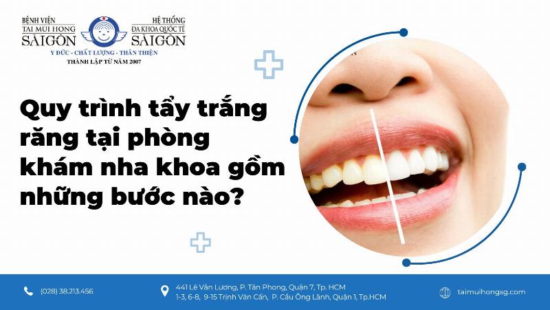 Quy trình các bước tẩy trắng răng tại phòng khám nha khoa chuyên nghiệp ở Việt Nam