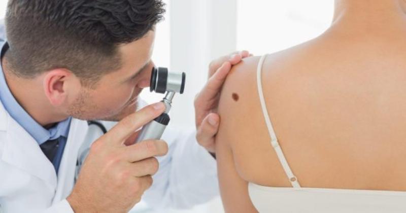 Hình ảnh nhấn mạnh tầm quan trọng của việc chống nắng khi sử dụng kem trị nám