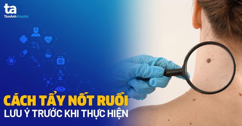 Bac si da lieu dang kiem tra not ruoi tren mat benh nhan