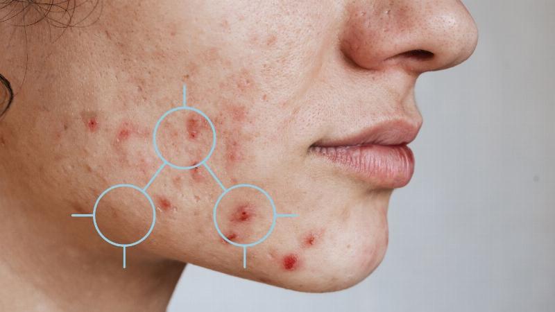 Hinh anh cac thanh phan chuyen tri tham mun trong my pham nhu Vitamin C Niacinamide Alpha Arbutin