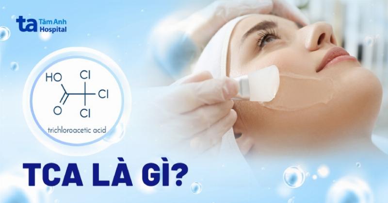 Minh hoa cac phuong phap tri tham mun tai phong kham nhu laser hoac peel da