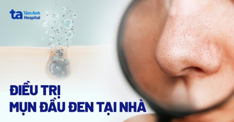 nhung-sai-lam-thuong-gap-khi-tri-mun-dau-den-tai-nha