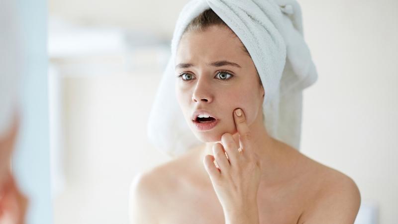 Hình ảnh minh họa các loại mụn phù hợp để sử dụng miếng dán mụn Derma Angel.