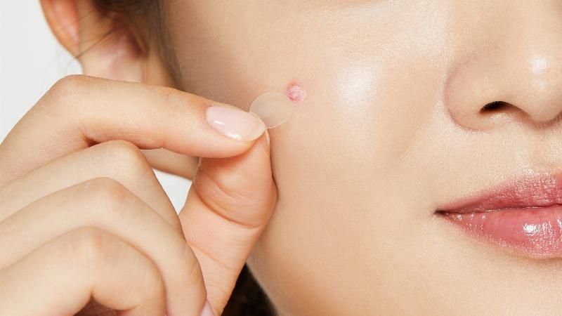 Các địa điểm mua miếng dán mụn Derma Angel uy tín tại Việt Nam như cửa hàng mỹ phẩm, nhà thuốc, sàn thương mại điện tử.