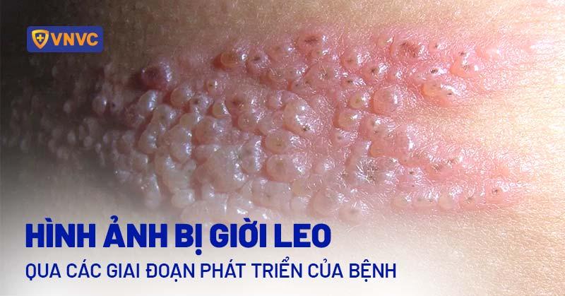 Hình ảnh một người đang vỗ nhẹ nước ấm lên mặt bằng tay.