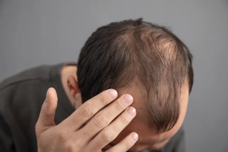 Hình ảnh một người phụ nữ vui vẻ với mái tóc chắc khỏe, minh họa trải nghiệm tích cực sau khi dùng biotin